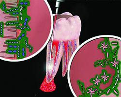 Лазерная стоматология - Взаимодействие фотосенсибилизатора с микробными клетками