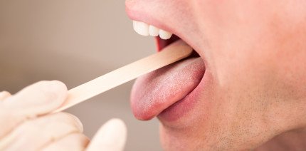 Папиллома полости рта - лечение